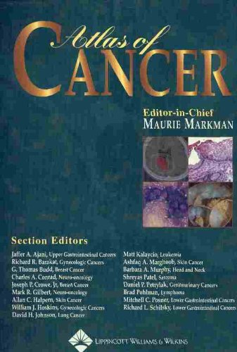 

special-offer/special-offer/atlas-of-cancer--9780781742801