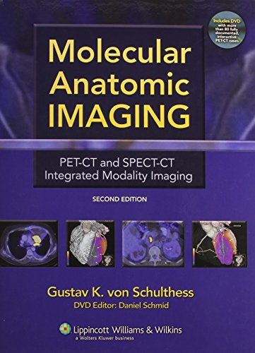 

special-offer/special-offer/molecular-anatomic-imaging-pet-ct-and-spect-ct-integrated-modality-imaging-included-dvd-2ed--9780781776745
