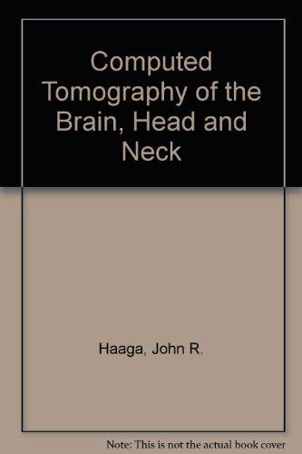 

special-offer/special-offer/computed-tomography-of-the-brain-head-and-neck--9780801620294