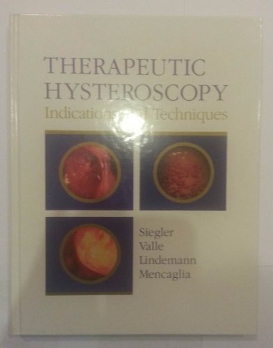 

special-offer/special-offer/therapeutic-hysteroscopy-indications-and-techniques--9780801655043