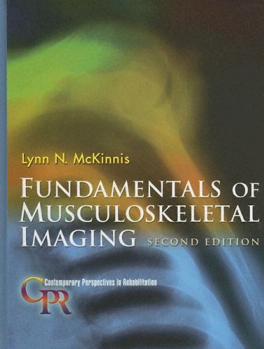 

special-offer/special-offer/fundamentals-of-musculoskeletal-imaging-2ed--9780803611887