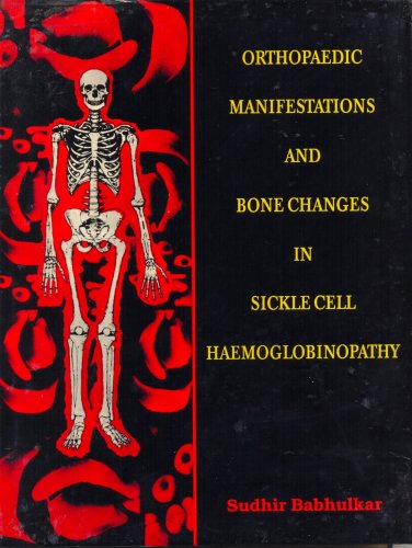 

best-sellers/cbs/orthopaedic-manifestations-and-bone-changes-in-sickle-cell-haemoglobinopathy-1997--9788123905778