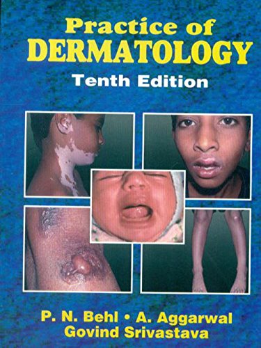 

best-sellers/cbs/practice-of-dermatology-10ed-pb-2020--9788123912837