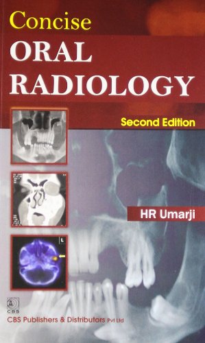 

mbbs/4-year/concise-oral-radiology-2e--9788123920085