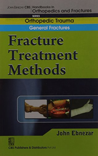 

best-sellers/cbs/fracture-treatment-methods-handbook-in-orthopedics-and-fractures-vol-02-orthopedic-trauma-general-fractures-2012--9788123920757