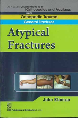 

best-sellers/cbs/a-typical-fractures-handbook-in-orthopedics-and-fractures-vol-4-orthopedic-trauma-general-fractures-2012--9788123920771