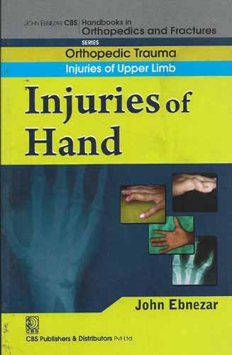 

best-sellers/cbs/injuries-of-hand-handbooks-in-orthopedics-and-fractures-series-vol-11-orthopedic-trauma-injuries-of-upper-limb-2012--9788123920849