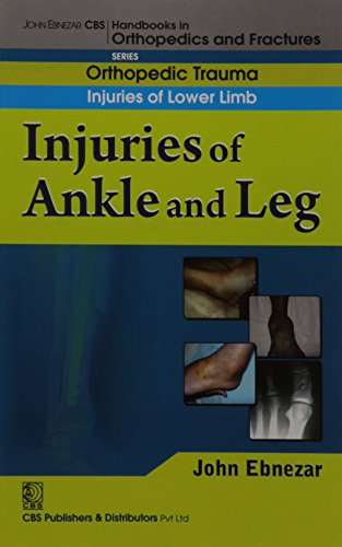 

best-sellers/cbs/injuries-of-ankle-and-leg-handbook-of-orthopedics-and-fratures-series-vol-17-orthopedic-trauma-injuries-of-lower-limb-2012--9788123920900