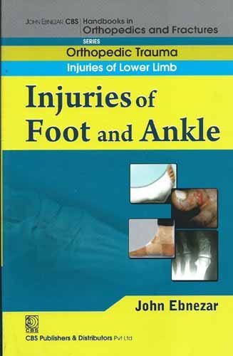 

best-sellers/cbs/injuries-of-foot-and-ankle-handbook-in-orthopedics-and-fractures-series-vol-18-orthopedic-trauma-injuries-of-lower-limb-2012--9788123920917