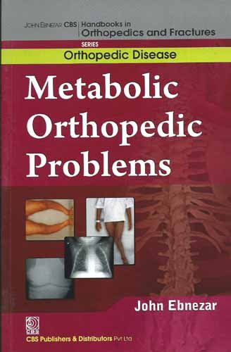 

best-sellers/cbs/metabolic-orthopedic-problems-handbooks-in-orthopedics-and-fractures-series-vol-30-orthopedic-disease-2012--9788123921082