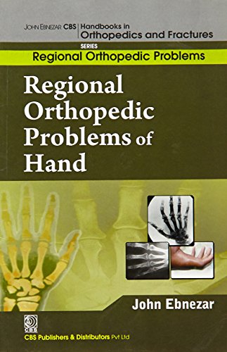 

best-sellers/cbs/regional-orthopedic-problems-of-hand-handbooks-in-orthopedics-and-fractures-series-vol-51-regional-orthopedic-problems-2012--9788123921297