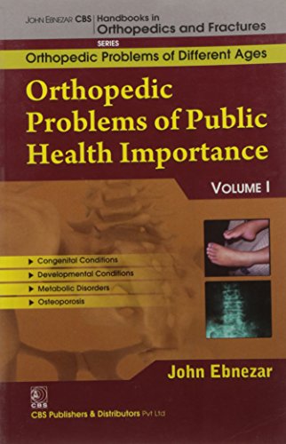 

best-sellers/cbs/orthopedic-problems-of-public-health-importance-handbooks-of-orthopedics-and-fractures-series-1-vol-82-orthopedic-problems-of-different-ages-2012--9788123921624