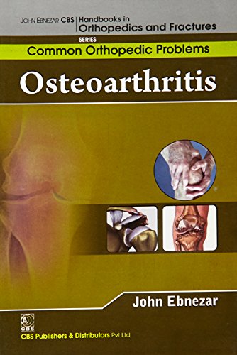 

best-sellers/cbs/osteoarthritis-handbooks-in-orthopedics-and-fractures-series-vol-87-common-orthopedic-problems-2012--9788123921679
