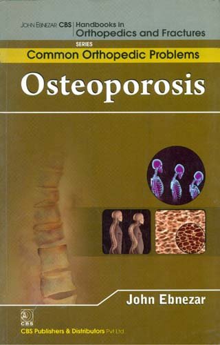 

best-sellers/cbs/osteoporosis-handbooks-in-orthopedics-and-fractures-series-vol-90-common-orthopedic-problems-2012--9788123921709