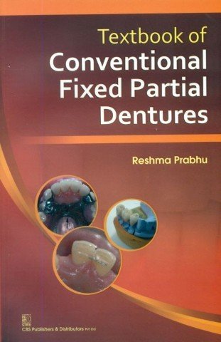 

dental-sciences/dentistry/textbook-of-conventional-fixed-partial-dentures-9788123923604