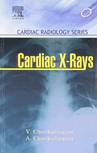 

special-offer/special-offer/cardiac-radiology-cardiac-imaging-series--9788131204504