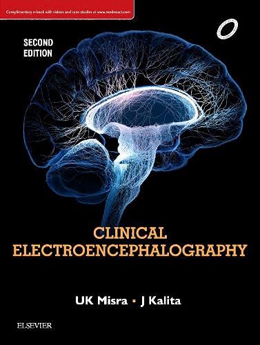 

general-books/general/clinical-electroencephalography-2e--9788131252956