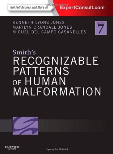 SMITH'S RECOGNIZABLE PATTERNS OF HUMAN MALFORMATION: EXPERT CONSULT - ONLINE AND PRINT
