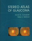 

special-offer/special-offer/stereo-atlas-of-glaucoma--9780815113997