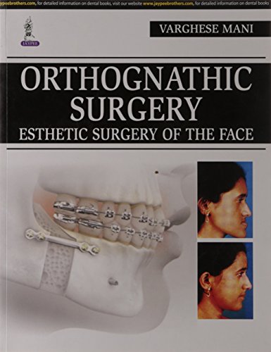 

special-offer/special-offer/orthognathic-surgery-esthetic-surgery-of-the-face--9788171794157