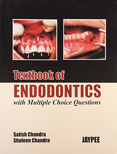 

special-offer/special-offer/textbook-of-endodontics--9788171798285