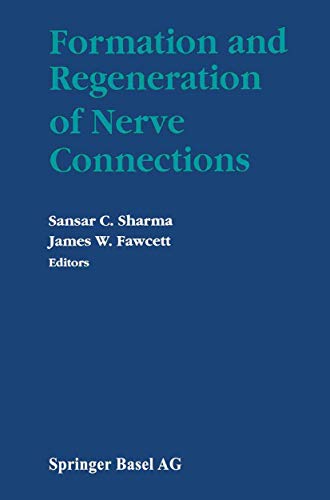 

special-offer/special-offer/formation-and-regeneration-of-nerve-connections--9780817635633