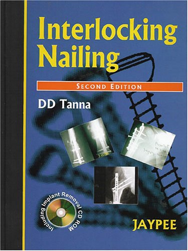 

special-offer/special-offer/interlocking-nailing-2ed-with-cd--9788180612275