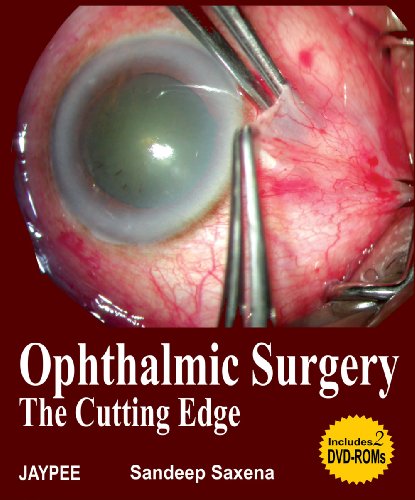 

special-offer/special-offer/ophthalmic-surgery-the-cutting-edge-includes-2-dvd-roms--9788180616341