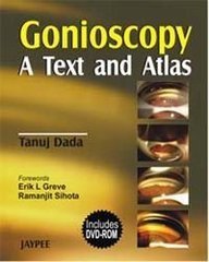 

general-books/general/gonioscopy-a-text-and-atlas--9788180616464