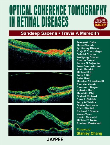 

general-books/general/optical-coherence-tomography-in-retinal-diseases-with-photo-dvd-rom-1-ed--9788180616495