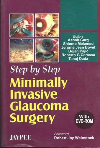 

best-sellers/jaypee-brothers-medical-publishers/step-by-step-minimally-invasive-glaucoma-surgery-with-dvd-rom-9788180617386