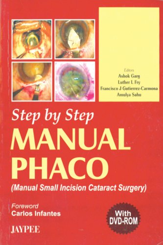 

best-sellers/jaypee-brothers-medical-publishers/step-by-step-manual-phaco-with-dvd-rom-9788180617454