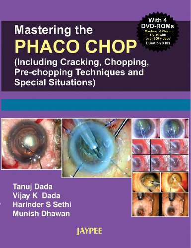 

surgical-sciences/ophthalmology/mastering-the-nucleotomy-techniques-in-phaco-with-4-dvd-roms--9788180619014