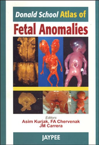 

special-offer/special-offer/donald-school-atlas-of-fetal-anomalies--9788180619199