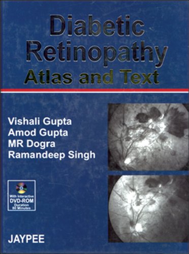 

general-books/general/diabetic-retinopathy-atlas-and-text-with-dvd-rom--9788180619298