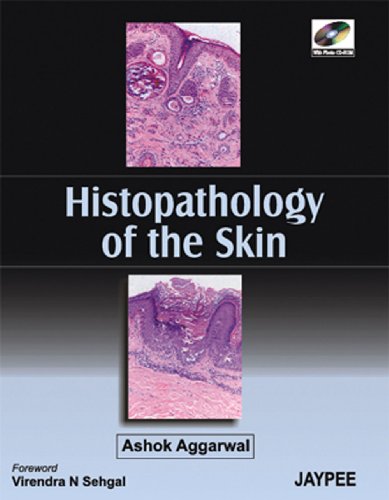 

special-offer/special-offer/histopathology-of-the-skin-with-cd-rom--9788180619519