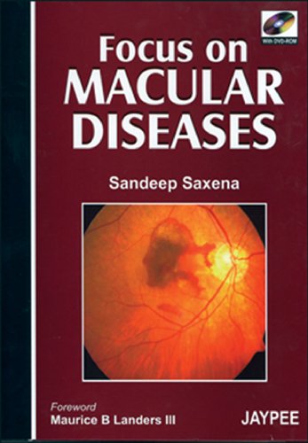 

best-sellers/jaypee-brothers-medical-publishers/focus-on-macular-diseases-with-dvd-rom-9788180619533