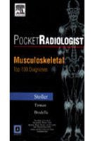 

special-offer/special-offer/pocket-radiologist-musculoskeletal-top-100-diagnoses--9788181471635