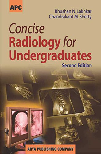 

surgical-sciences/cardiac-surgery/concise-radiology-for-undergraduates-2-ed-9788182964785