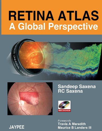 

general-books/general/retina-atlas-a-global-perspective-with-dvd-rom--9788184482195