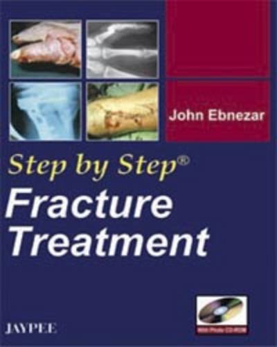 

best-sellers/jaypee-brothers-medical-publishers/step-by-step-fracture-treatment-with-photo-cd-rom-9788184482546