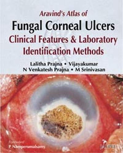 

best-sellers/jaypee-brothers-medical-publishers/aravind-s-atlas-of-fungal-corneal-ulcers-clinical-features-lab-identification-methods-9788184483659