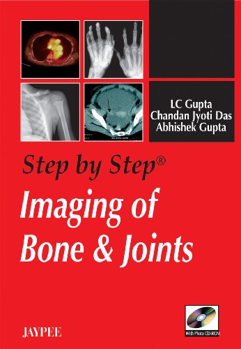 

clinical-sciences/radiology/step-by-step-imaging-of-bone-joints-with-photo-cd-rom-1-ed--9788184483697