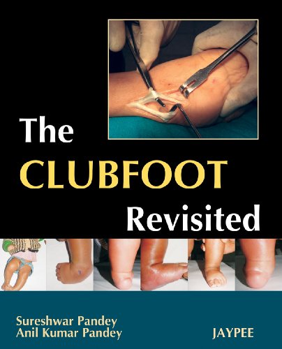 

best-sellers/jaypee-brothers-medical-publishers/the-clubfoot-revisited-9788184484359