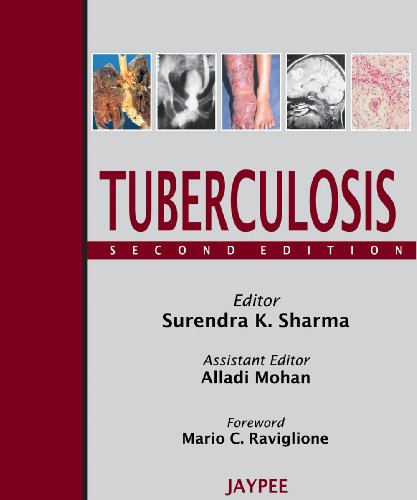 

special-offer/special-offer/tuberculosis--9788184485141