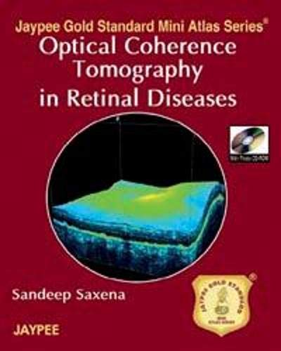 

best-sellers/jaypee-brothers-medical-publishers/jaypee-gold-standard-mini-atlas-series-optical-coherence-tomography-in-retinal-disea-photocd-rom-9788184488005