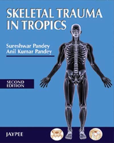 

best-sellers/jaypee-brothers-medical-publishers/skeletal-trauma-in-tropics-9788184489910