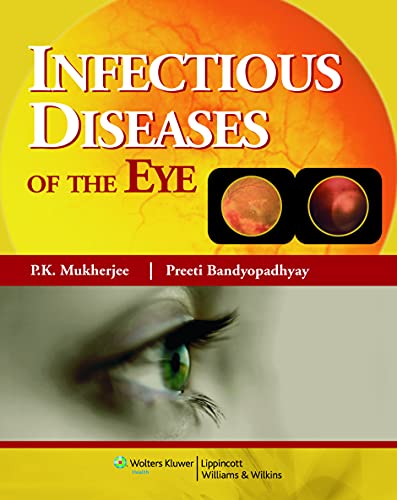 

general-books/general/infectious-diseases-of-the-eye--9788184731989