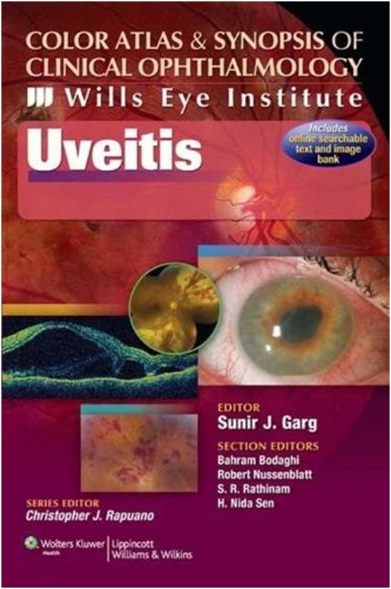 COLOR ATLAS & SYNOPSIS OF CLINICAL OPHTHALMOLOGY - UVEITIS