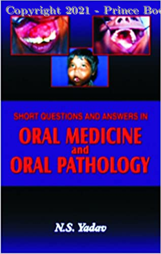 

dental-sciences/dentistry/short-questions-ans---oral-medicine-and-patholog-9798185386057